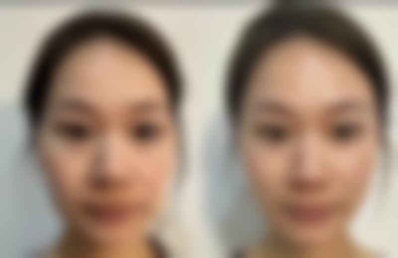 李甜医生收费价格表