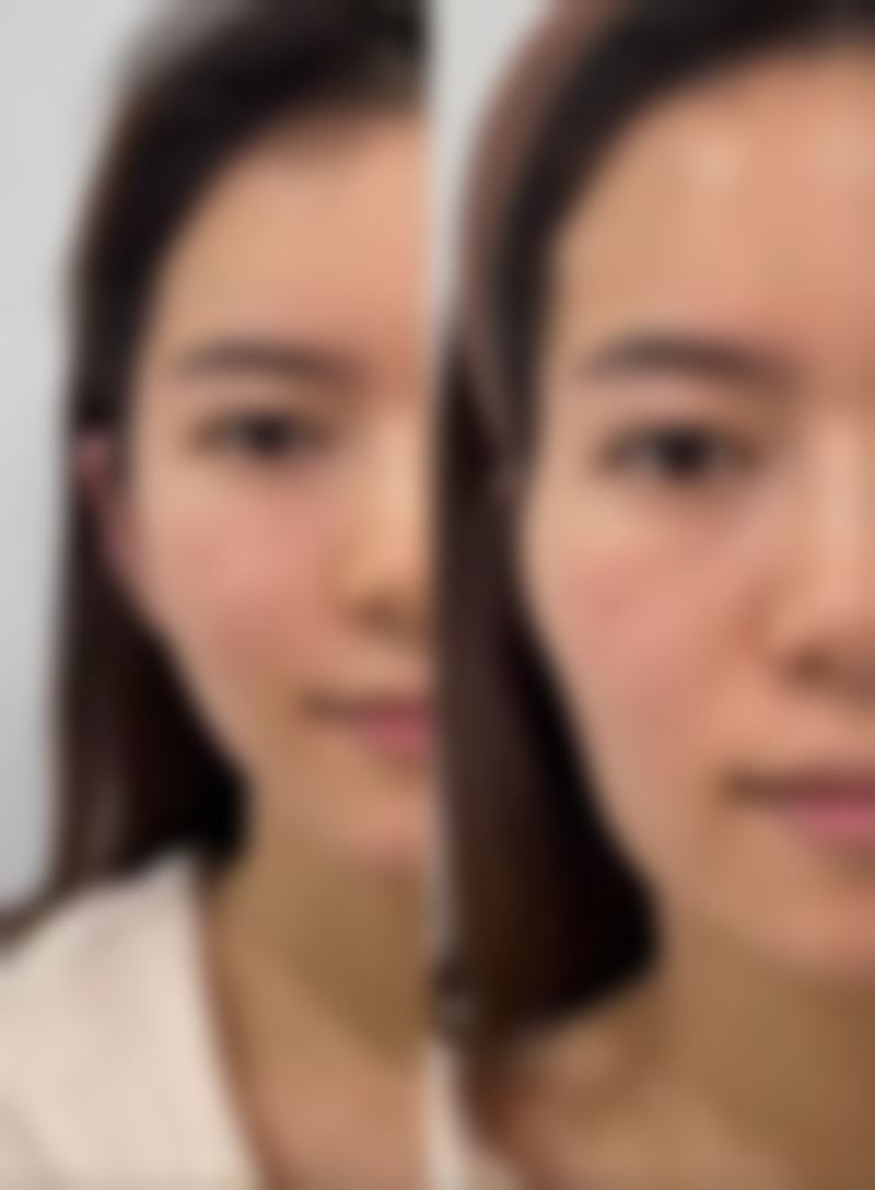 李甜医生技术优势