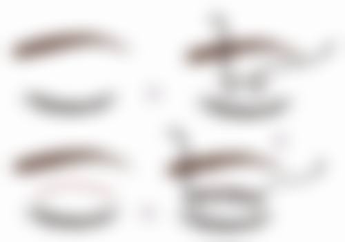 九、患者常见问题解答（精选）