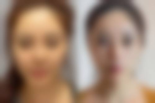 北京冰新丽格医疗美容电话：400-832-0xxx，预约隋冰医生拉皮，低至29800元起！ 