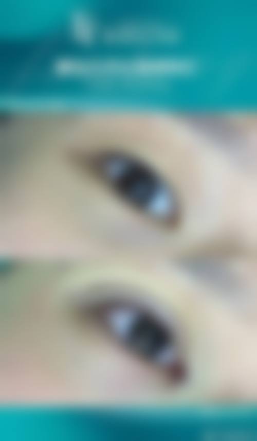 南京华美眼部做得好的医生之王小林