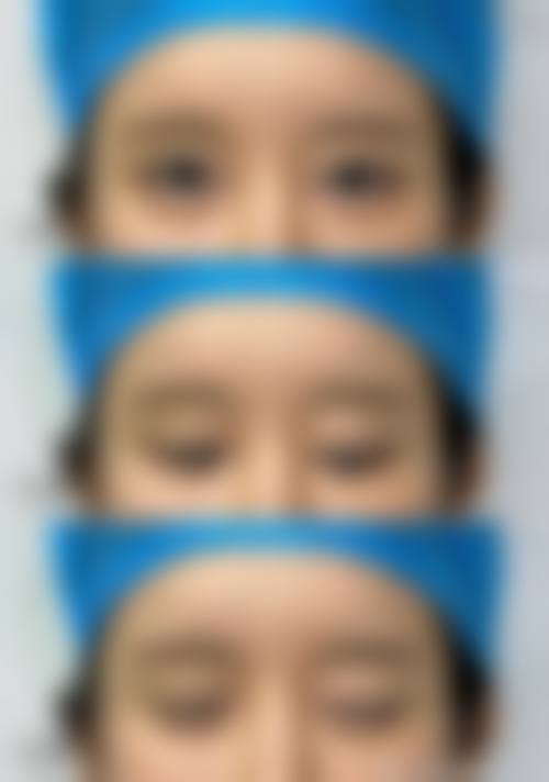 广州美莱陈贵宗：20年专注铸就眼修复传奇