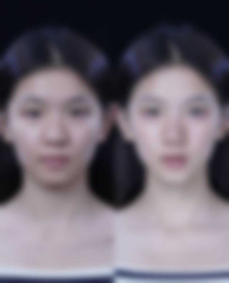 3D生物束带与东莞现代妇产医院