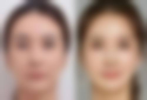 上海吴建明医生的口碑和成功实例多吗