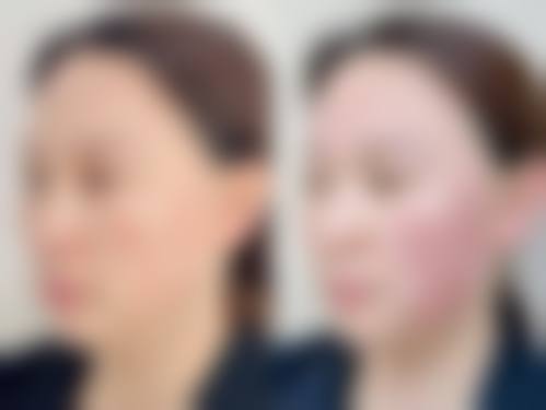 轻医美优选:成都艺星与悦好医疗美容医院