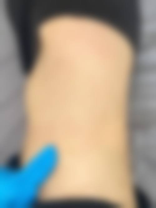 五、沈阳辽沈华美医院(疤痕科)的贴心服务