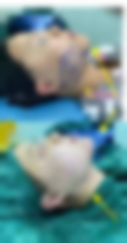 宁波韩美医疗美容整形机构口碑如何？