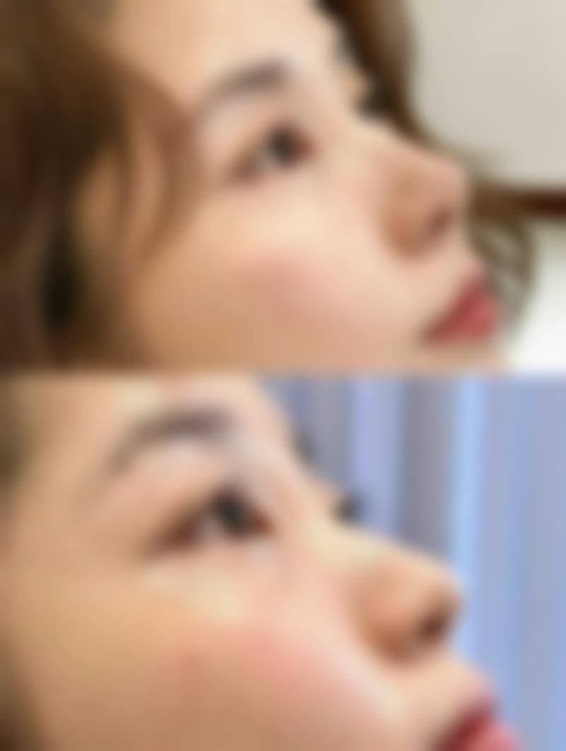宁波韩美医疗美容整形机构患者常见问题解答