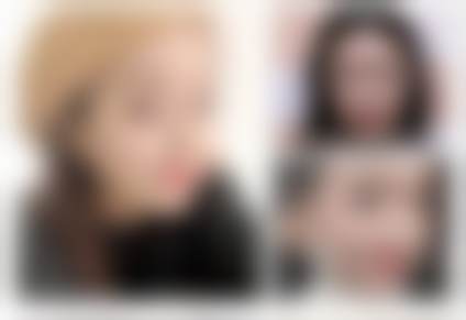 北京画美医疗美容显微眼部综合整形技术亮点