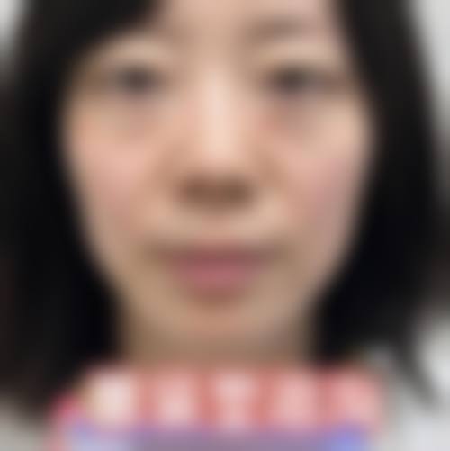 六、日常如何预防眼袋的产生?