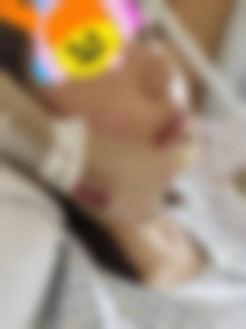 广州广大医院怎么样——正颌手术优势