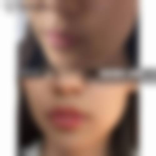 洛阳其他口碑整形医院推荐