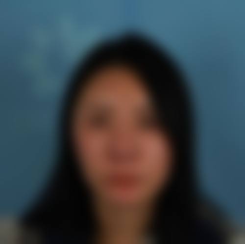 七、半肋骨隆鼻的费用与恒久性的关系