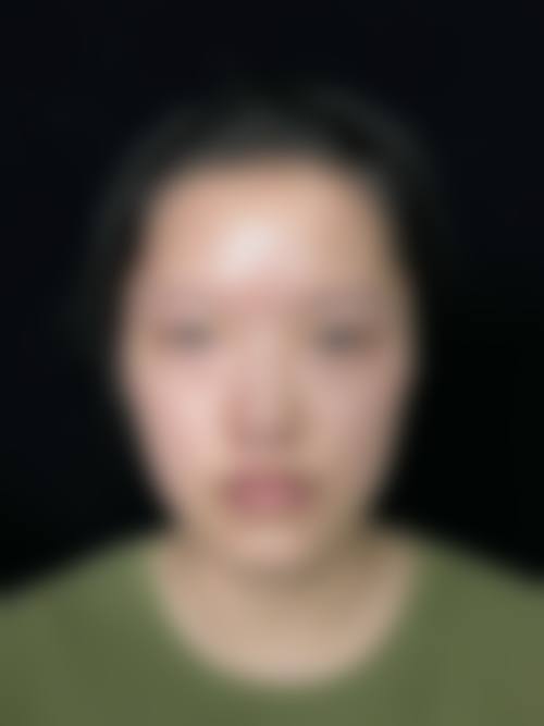 八、如何选择适合自己的双眼皮修复医生？