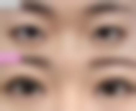 选择成镇模院长的优势与建议
