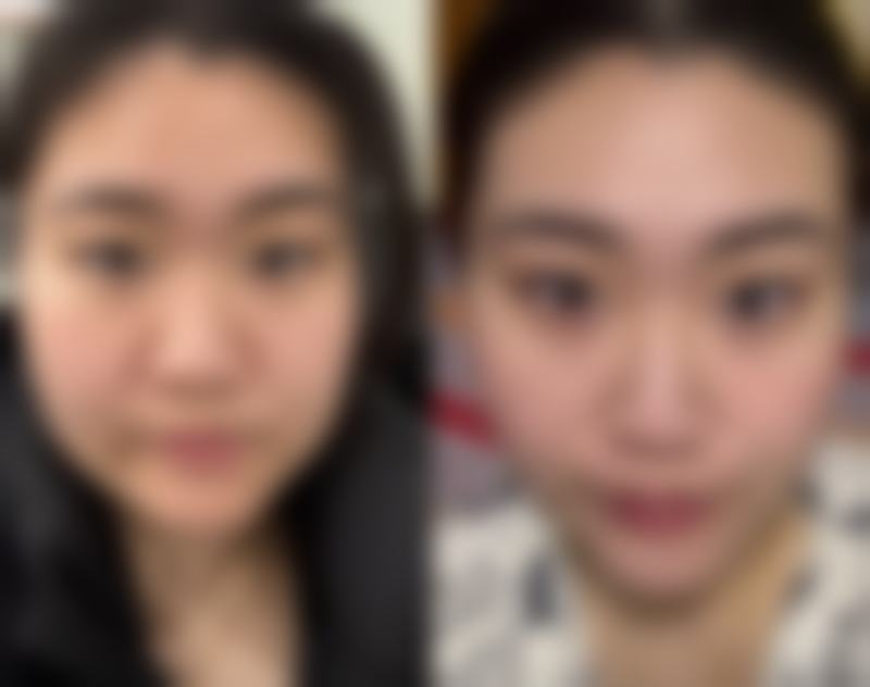 韩国爱特乐皮肤整容外科患者常见问题解答