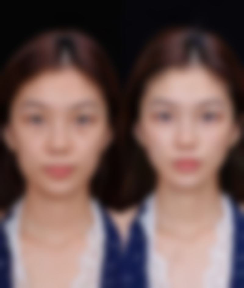 韩国爱特乐皮肤整容外科特色诊疗项目
