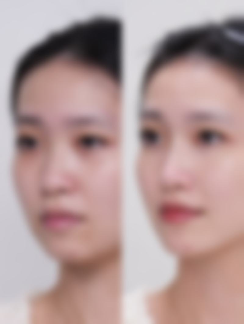 成都圣美汇医学美容门诊部口碑评价怎么样？