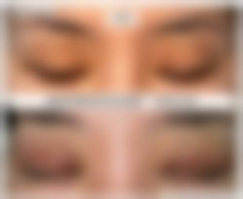 吉安艺美医疗整形美容医院核心技术与诊疗优势