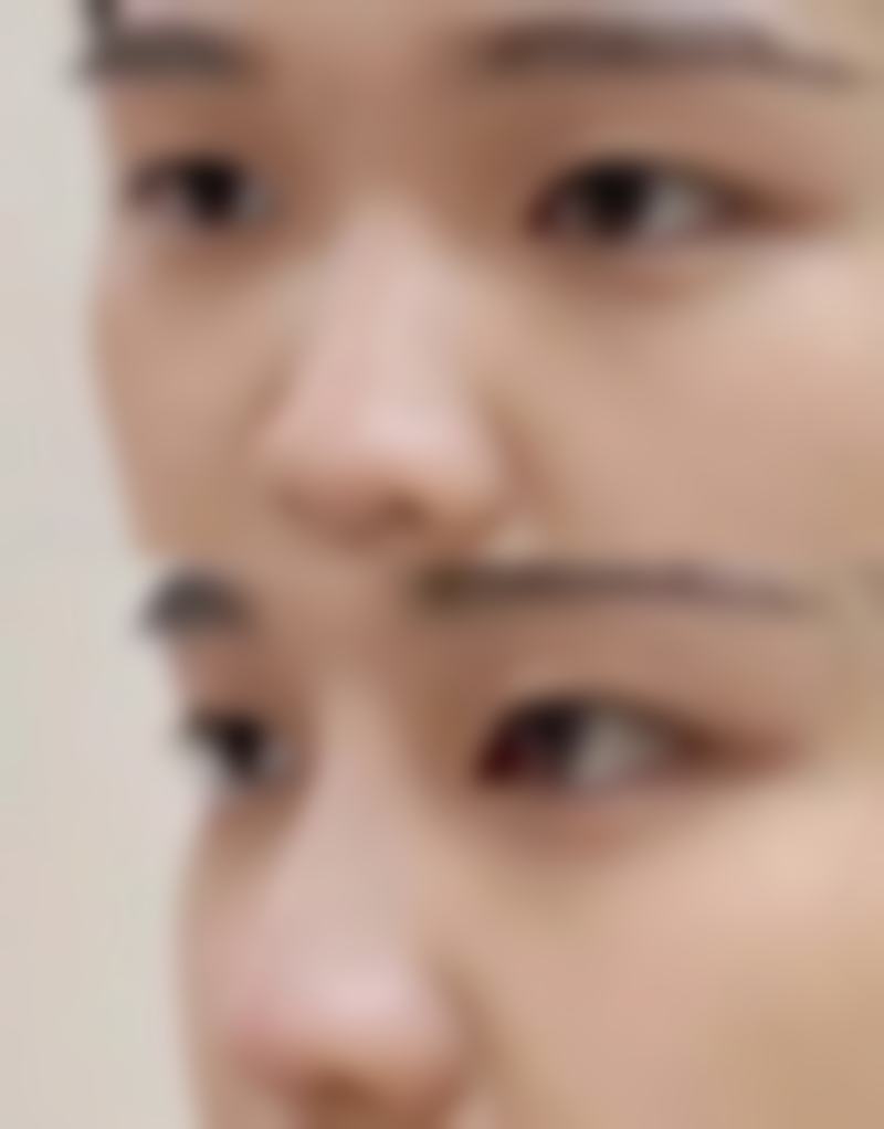 朴秀镐医生真实实例与患者评价