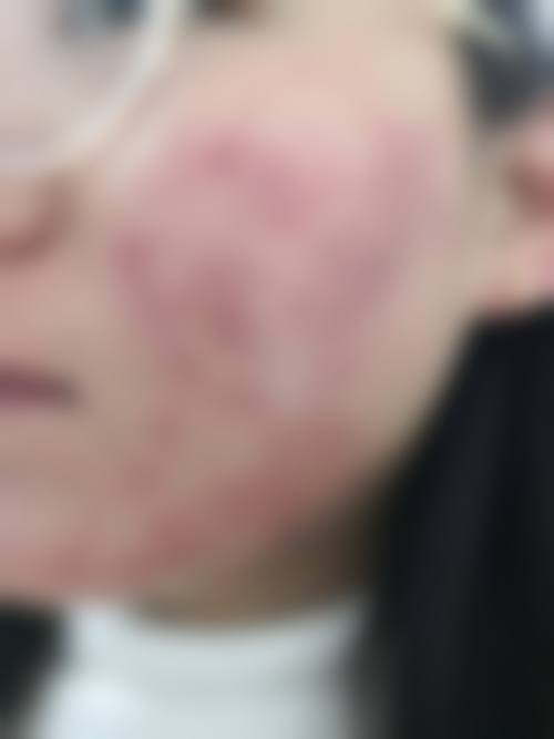 【四川成都大华医学美容医院口碑与真实评价】
