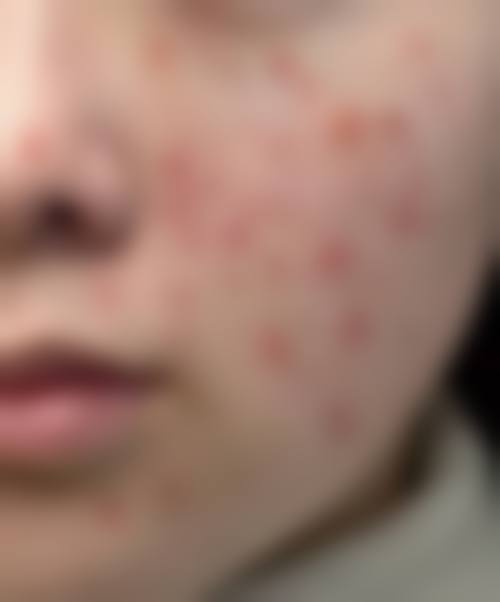 深圳福华中医和西医结合医院皮肤美容科简介概述