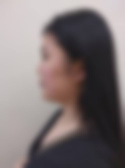 嘉兴华 山医疗美容医院真实实例收集与优势提炼