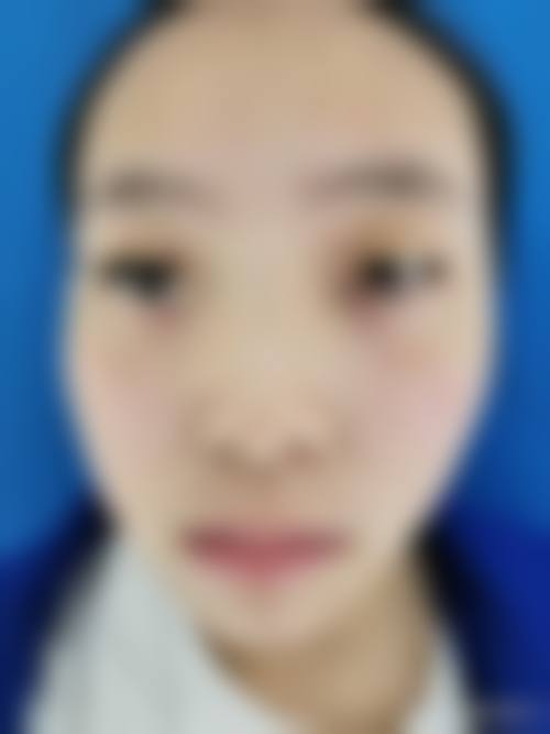 【四川成都大华医学美容医院技术优势】