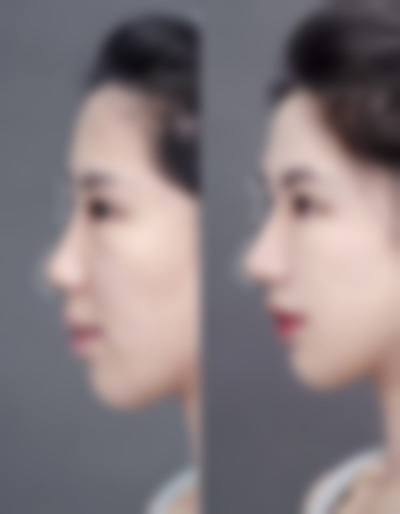 六、重庆芳奈儿整形医院口碑怎么样?真人好评反馈