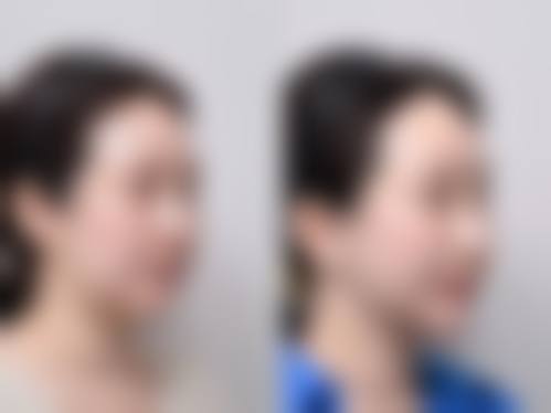 苏州婉美整形医疗美容诊所怎么样?