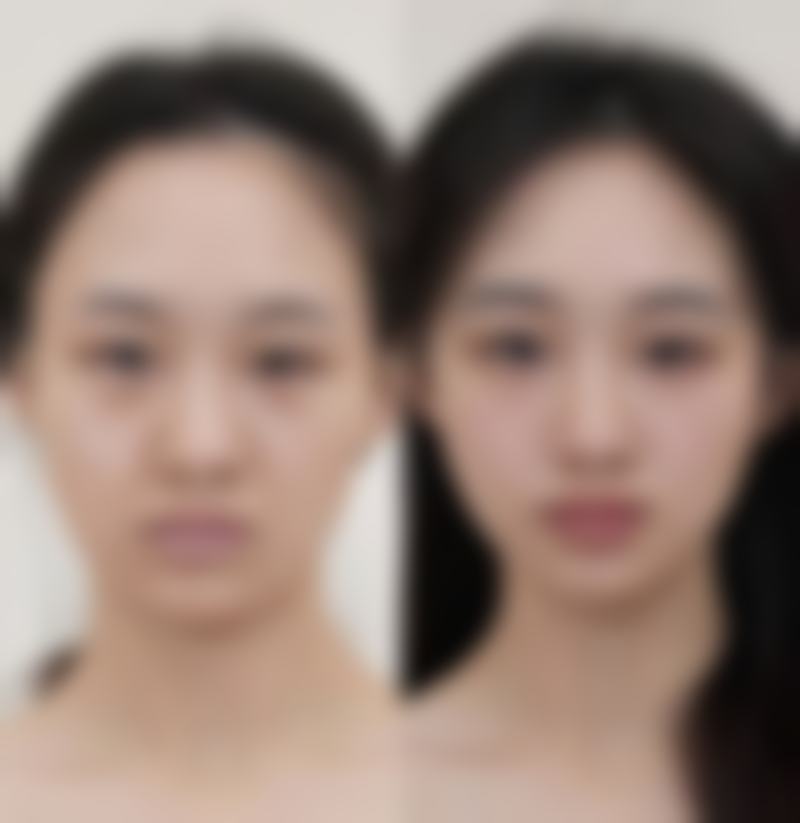 吉林冯淑娴医疗美容诊所患者口碑评价