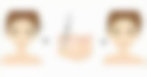 正规机构选择:医美安心的关键