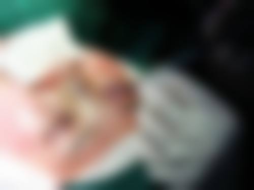 黄其然医生擅长项目