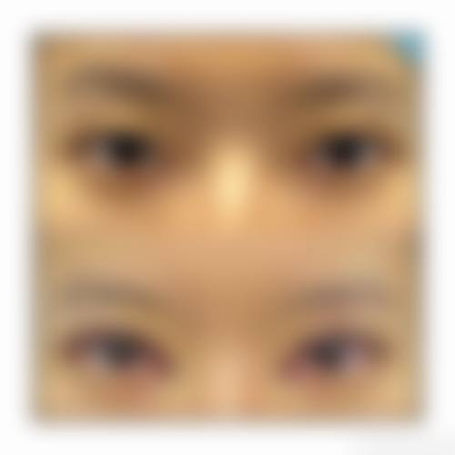 医美领域
