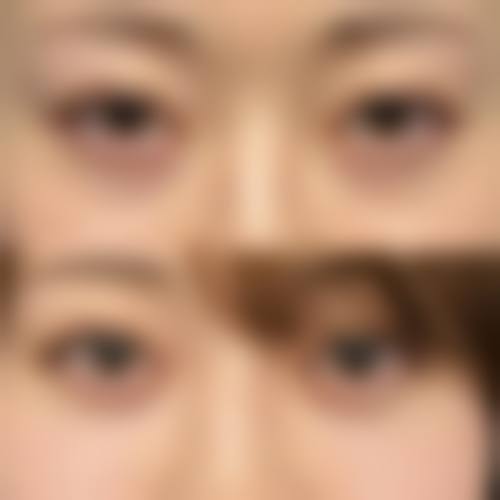 去眼袋什么更好更有效之日常护理