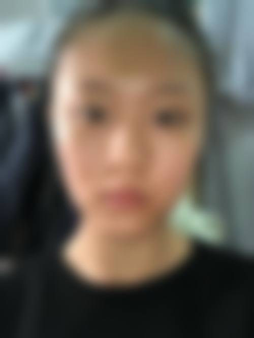 重庆柳叶刀医疗美容门诊部真实实例参考