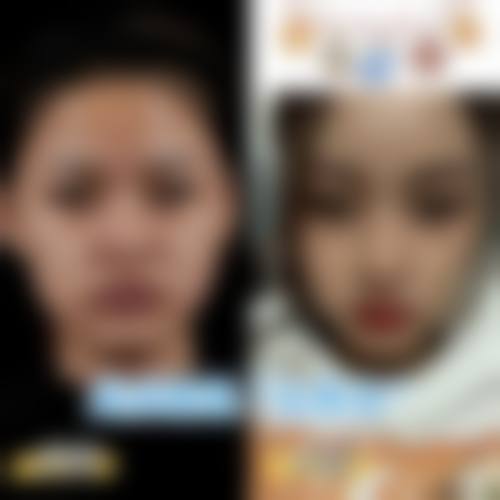 三、赵延勇的好口碑在患者实例中如何体现?