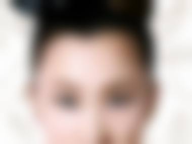 八、广州曙光植发医院价格表能帮你告别脱发烦恼吗?
