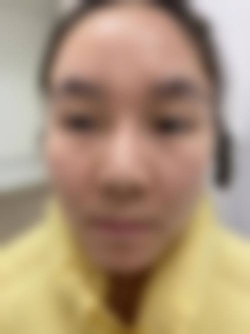 五、多领域整形实力,赵延勇在哪些项目上大放异彩?