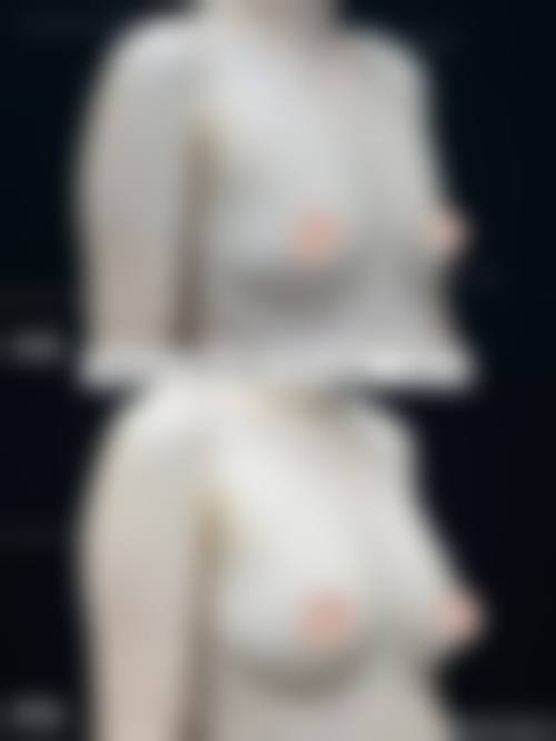 眼科领域