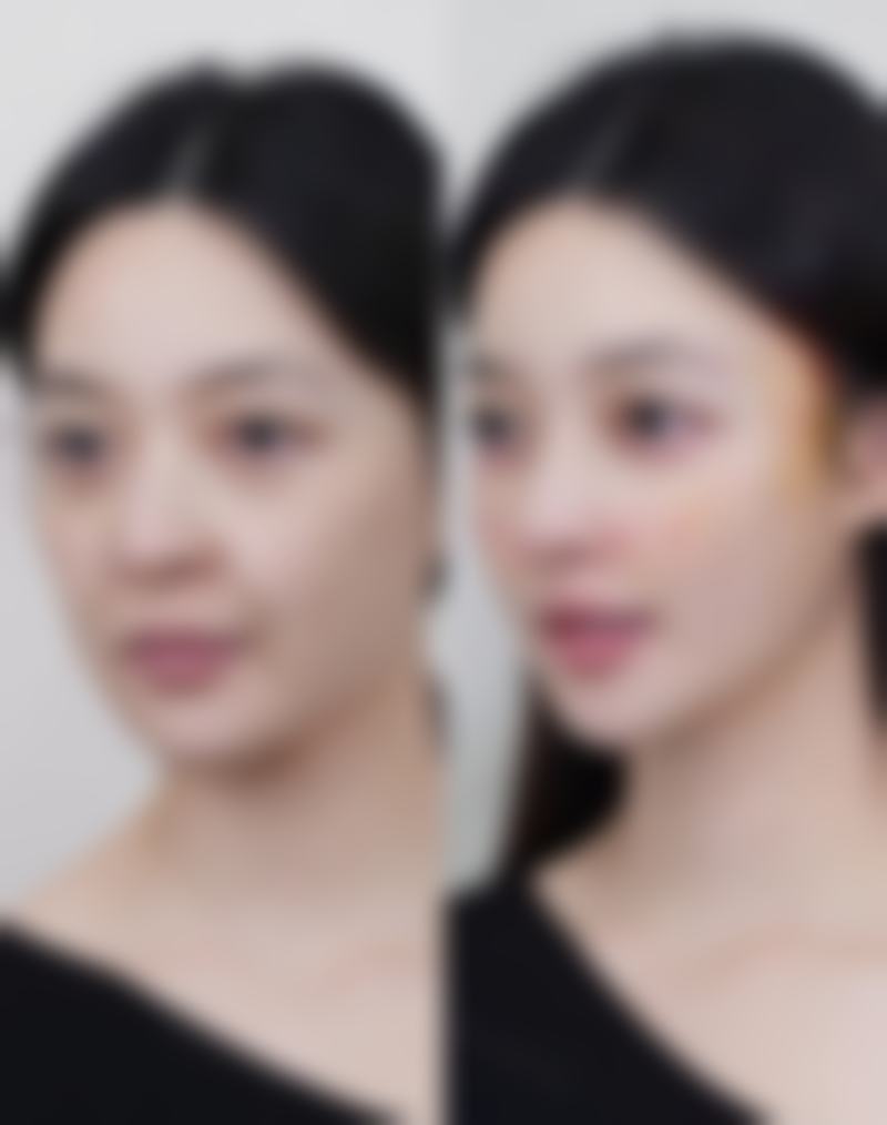 组合项目优惠方案