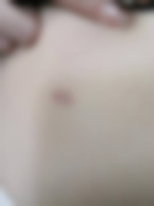 五、长沙中科皮肤病医院的费用及服务情况