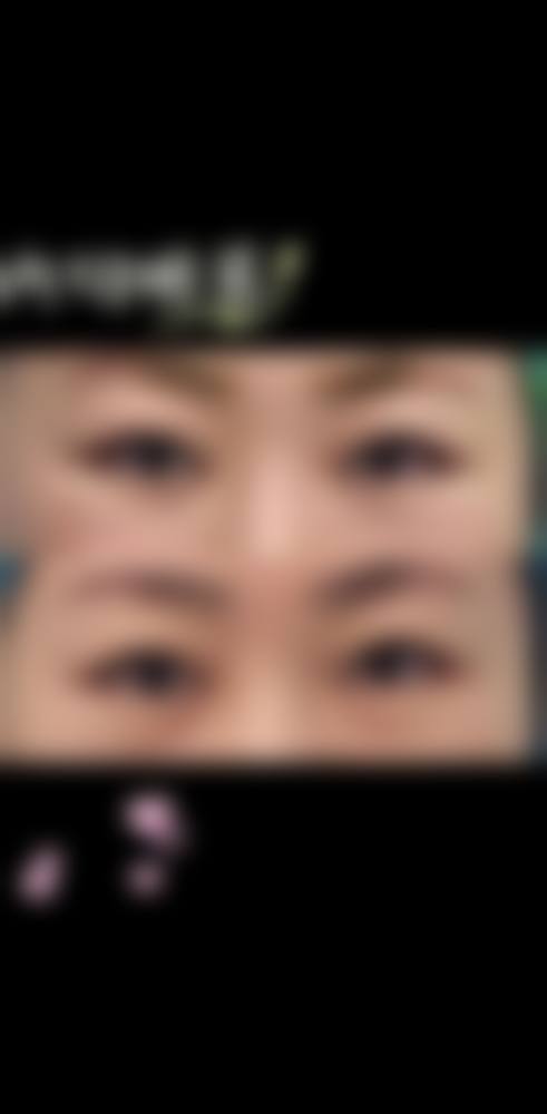 深圳中信健康整形医院收费价格表/收费标准