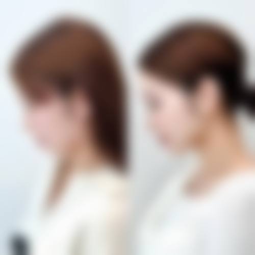 成都果美整形医疗美容门诊部收费参考:10+核心项目透明化展示