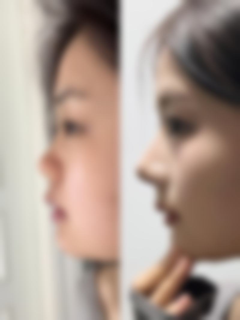 上海市沪中医疗美容医院官网揭秘：超厉害的李峰医生与优质美容整形服务！ 