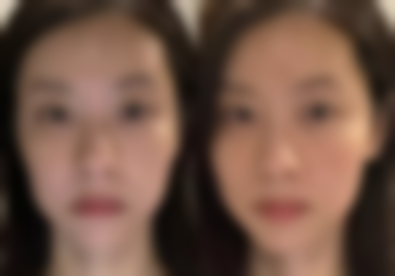 整形外科实力医院：专精保护美丽