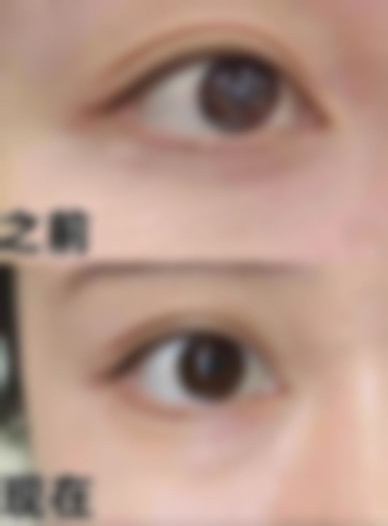 深圳中信健康整形医院真人口碑评价怎么样?
