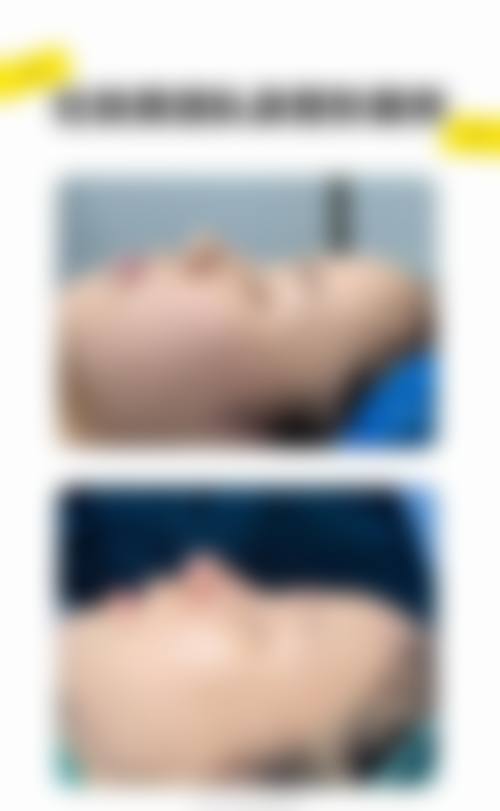 李懋医生擅长项目