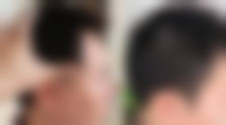 上海薇琳植发详细的预约挂号方式及流程