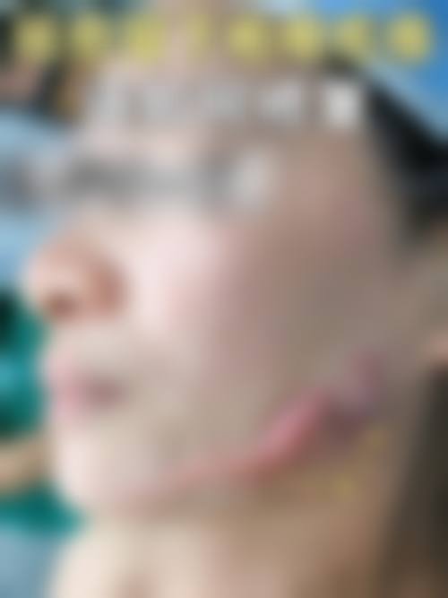 上海第九疤痕修复专科医院靠谱吗？全国排名前列，擅治疑难疤痕效果好！ 